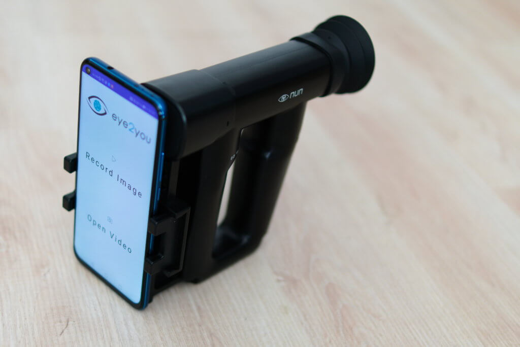 Hand-held funduscope with software from eye2you